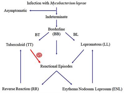 Editorial: The Role of Biomarkers in the Immunopathology and Diagnosis of Immune Exacerbations in Leprosy—New Frontiers to Manage This Neglected Disease